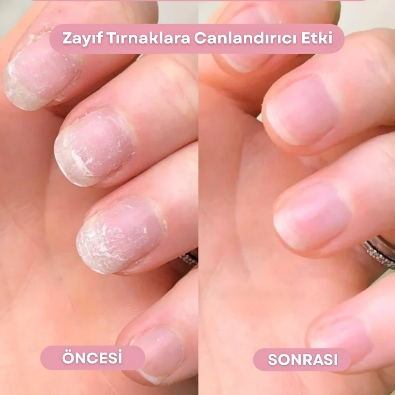 ZerNail™ | Uzatıcı & Güçlendirici Bakım Yağı