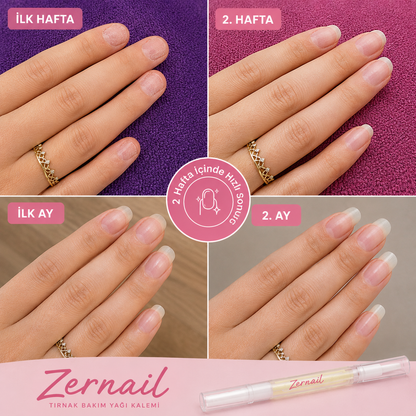 Zernail™ Uzatıcı ve Güçlendirici Bakım Yağı